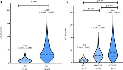 The role of Annexin A3 in coronary arterial lesions in children with Kawasaki disease